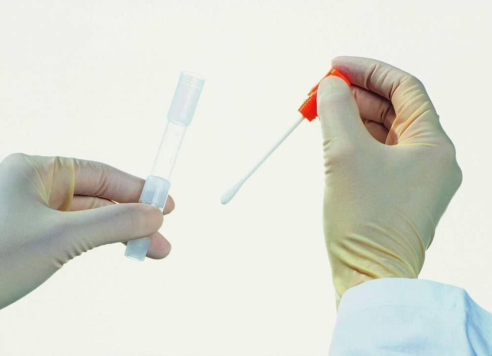 Testide kogumine kroonilise prostatiidi tuvastamiseks